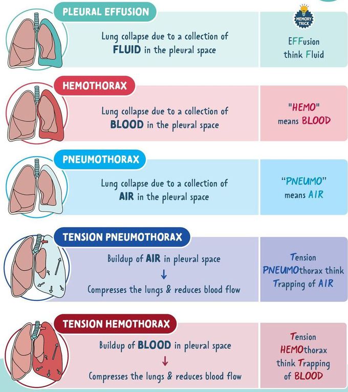 Chest Tube Indications