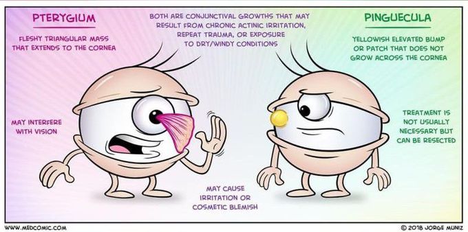 Pterygium Vs Pinguecula