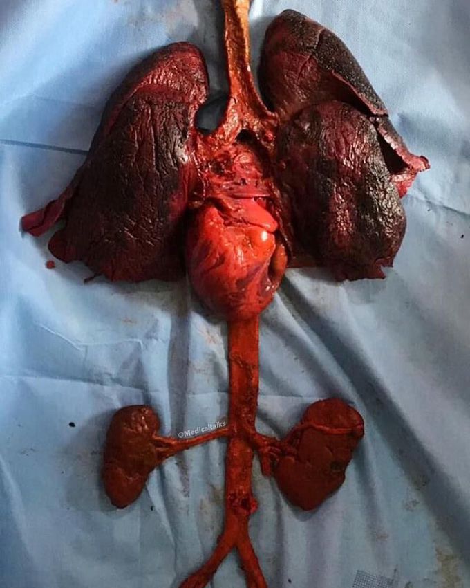 When the major organs of the human body are living in harmony! 