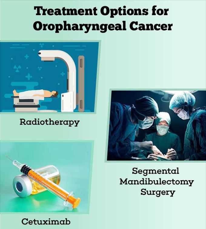 Treatment for Oropharyngeal cancer
