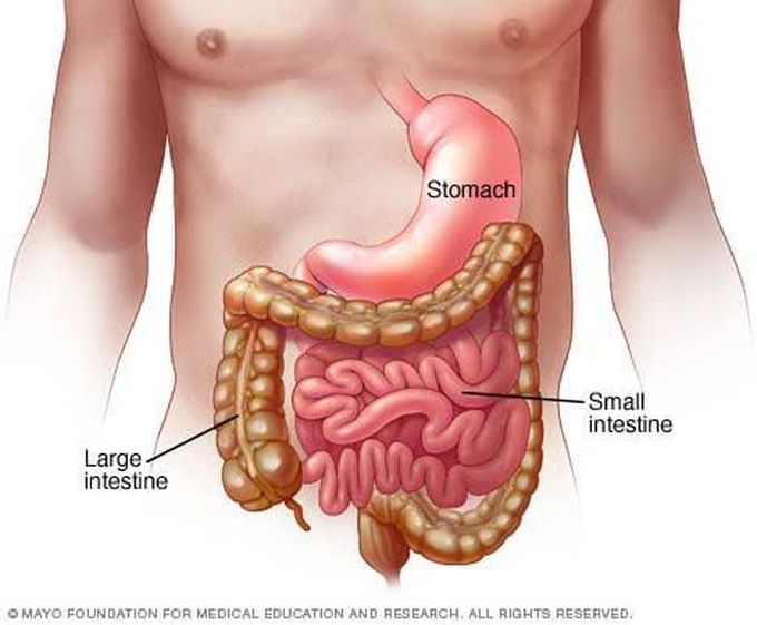 Complications of gastroenteritis