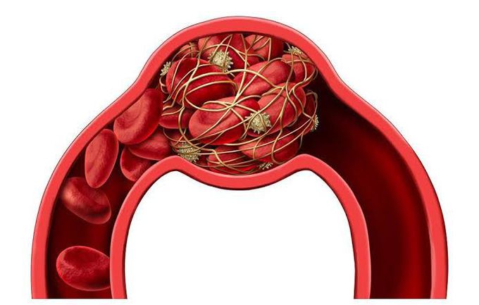 How to prevent formation of blood clots?