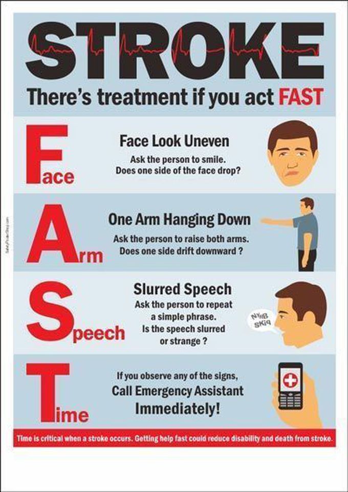 Stroke act fast