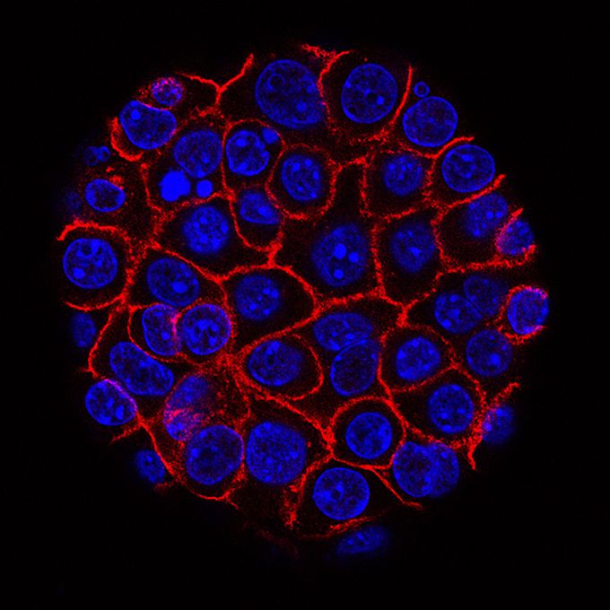 Researchers identify a mechanism that fuels cancer cells' growth