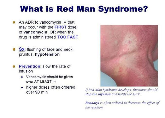 Red man syndrome