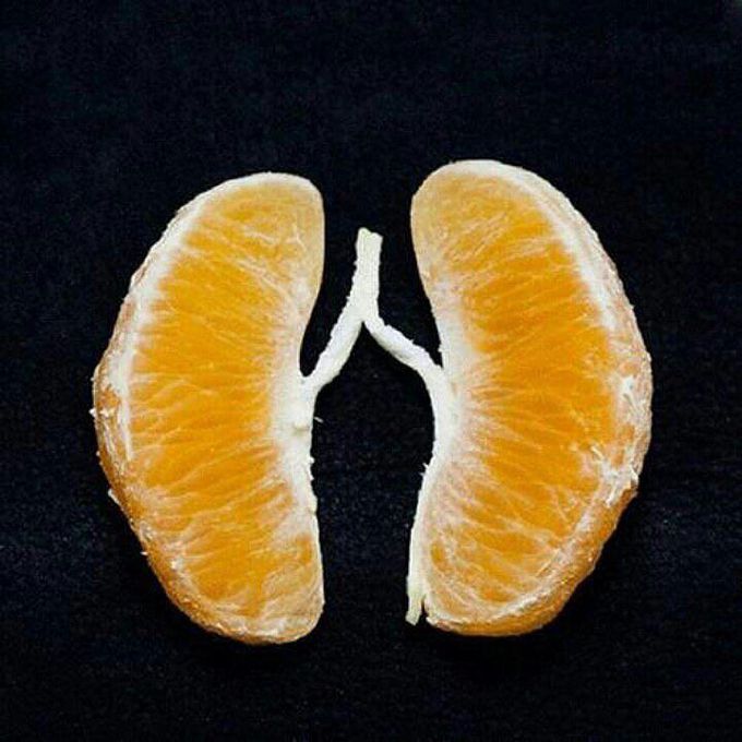 What does this photo look like?