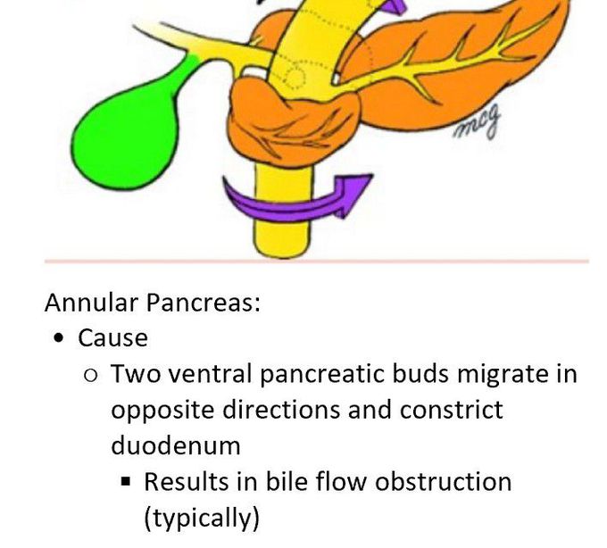 Cause of annular pancreas