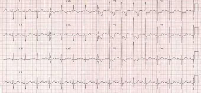What is your diagnosis