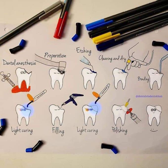 Reconstruction of 🦷 tooth