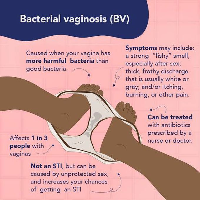 Risks of bacterial vaginosis
