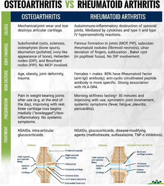 Osteoarthritis Vs Rheumatoid Arthritis
