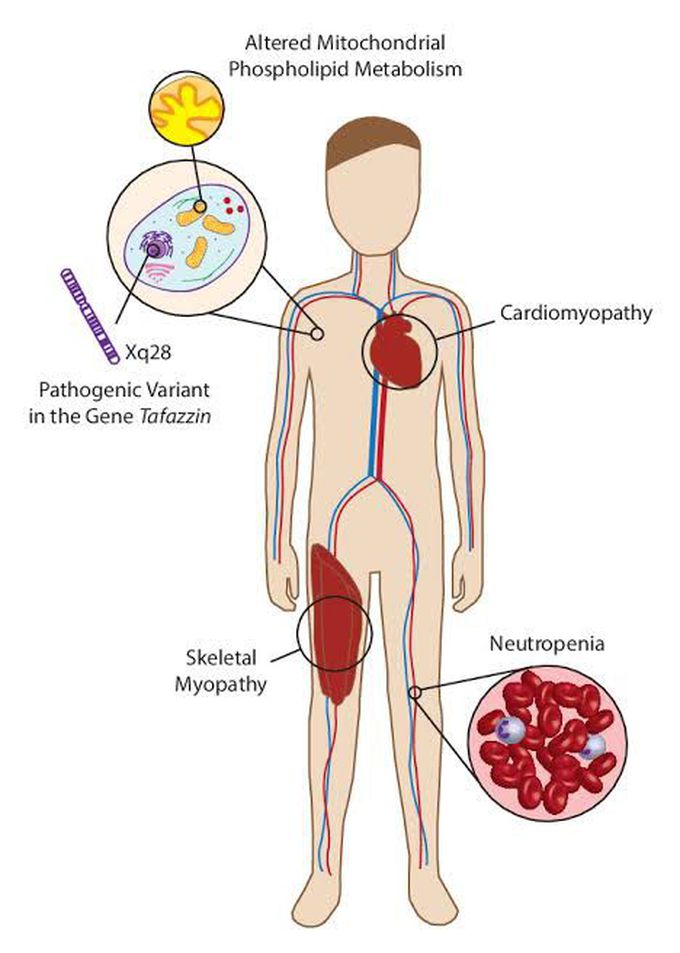 Treatment options for barth syndrome