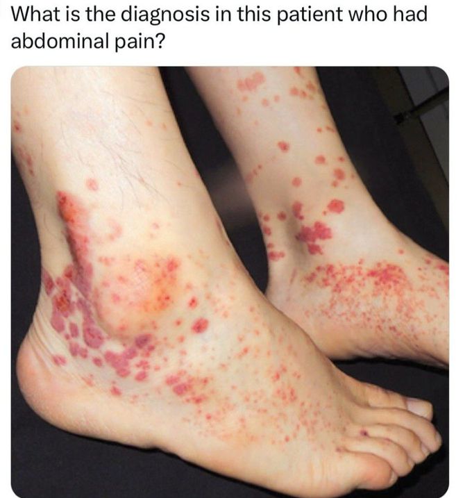 Diagnose It