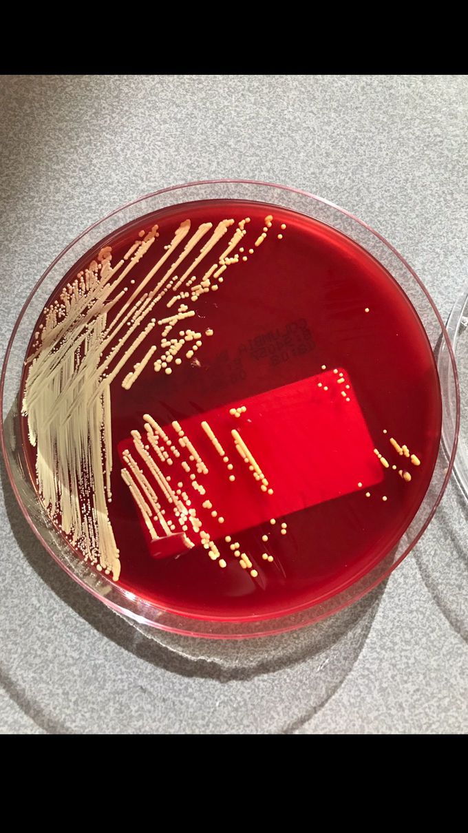 Micrococcus luteus