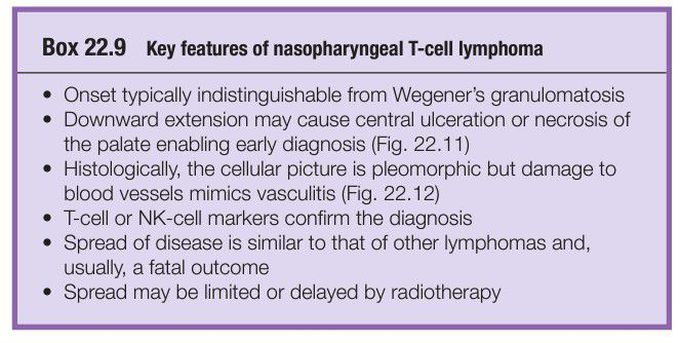 Nasopharyngeal lymphoma