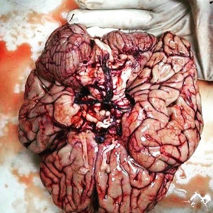 Human Brain