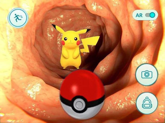 Amazing discovery during colonoscopy!