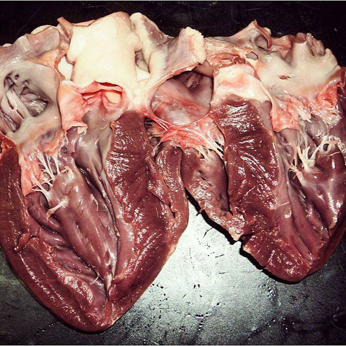 This is how the heart looks on dissection!