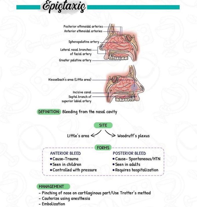 Epistaxis