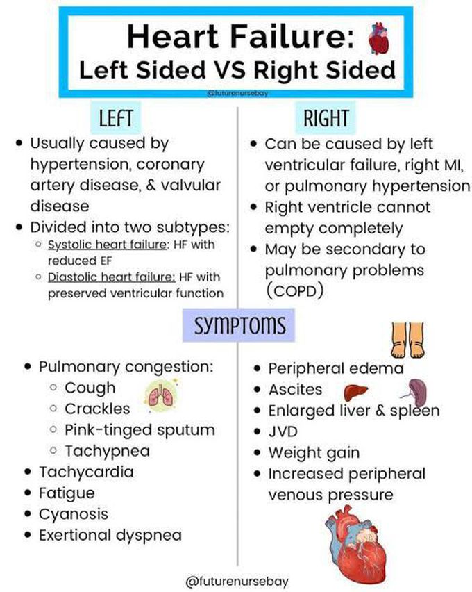 Left Sided vs Right Sided Heart Failure