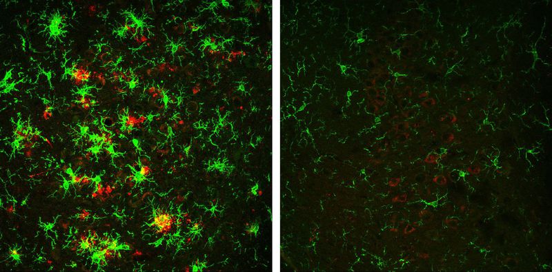 Researchers successfully reverse Alzheimer's disease in mouse model Researchers successfully reverse Alzheimer's disease in mouse model