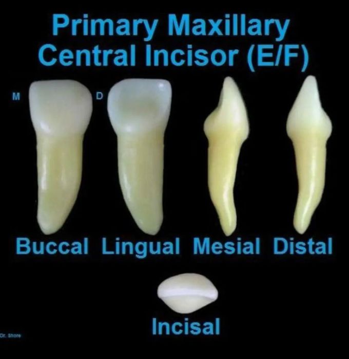 Primary Maxillary Central Incisor