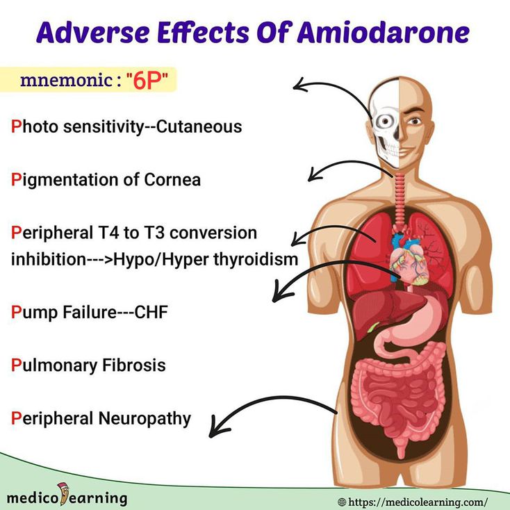 amiodarone side effects