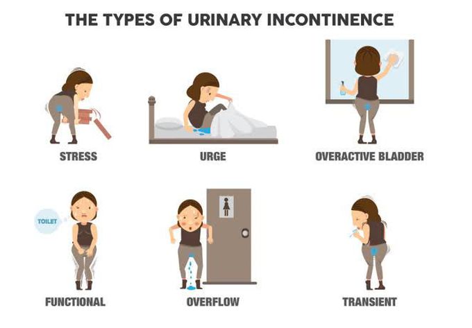 Causes of urinary incontinence