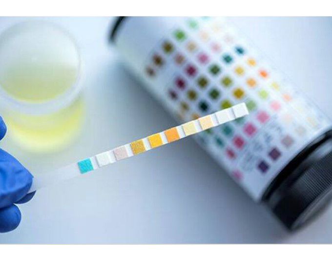 URINALYSIS
