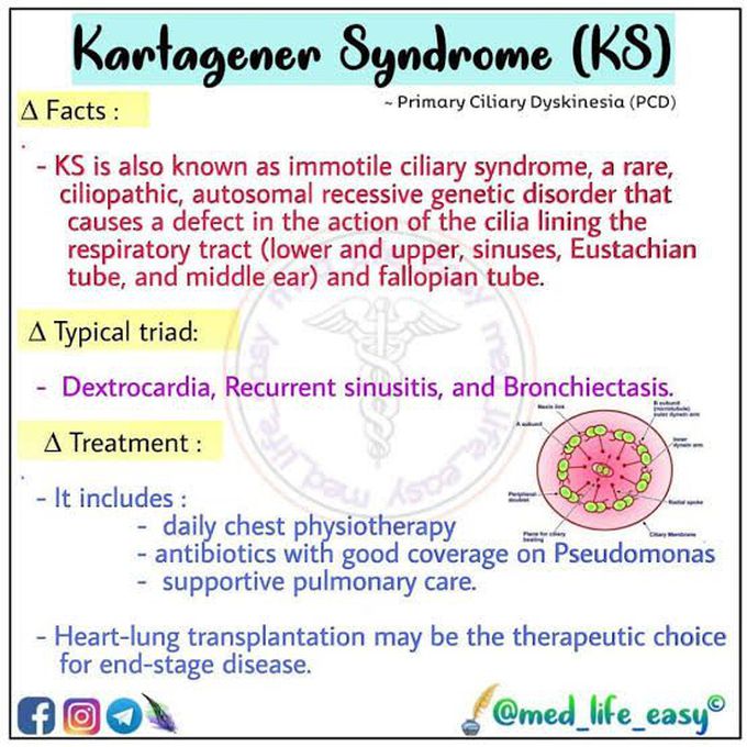 Kartagener syndrome treatment