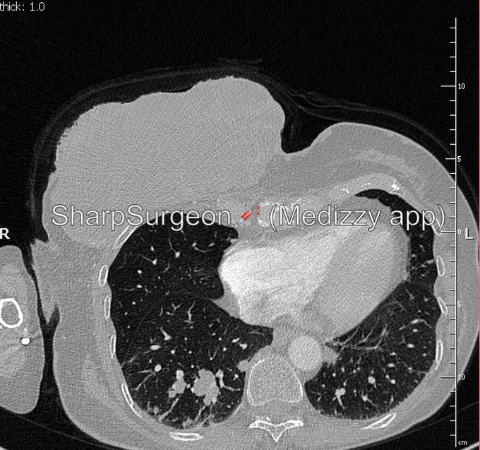 ❓Diagnosis❓