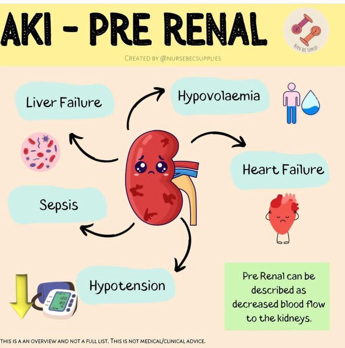 AKI PRERENAL