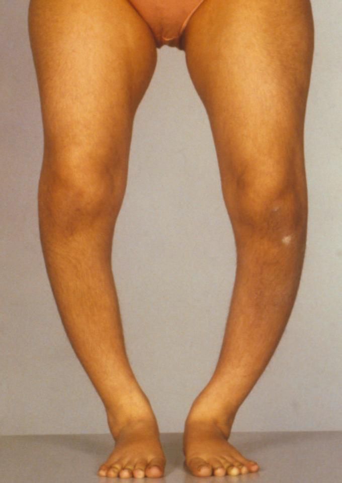 Name this condition? - MEDizzy