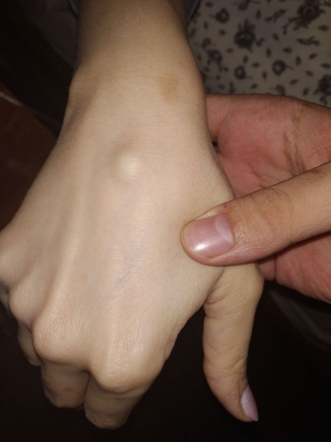Diagnosis?