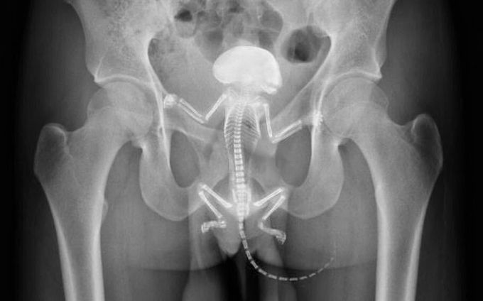 Man transported to hospital after having a squirrel MONKEY stuck in his RECTUM!