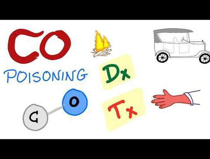 CO poisoning Diagnosis and Treatment