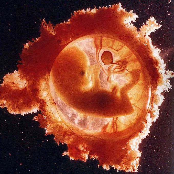 Three month old fetus in his womb