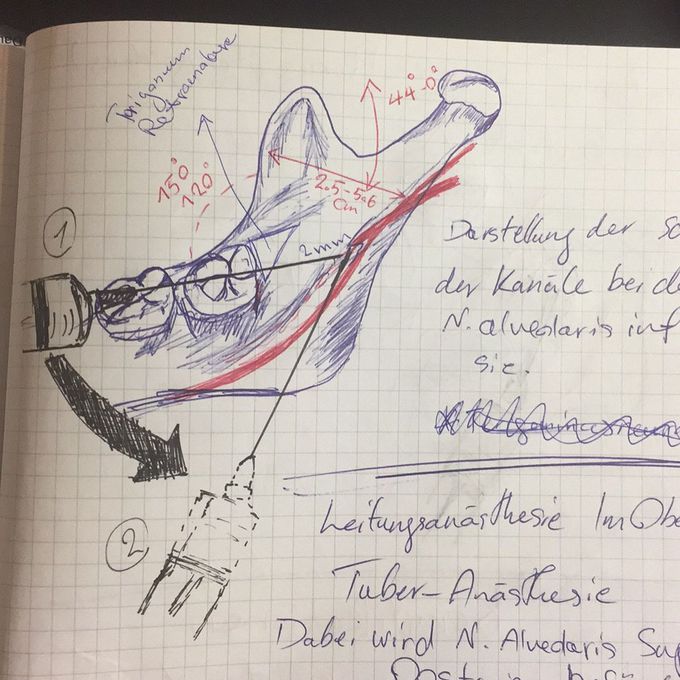 My Anatomy Script 📝as I was a Med. Student :
Years ago when there was no tablet and no smart phone📱💻 I was much more smarter. Old Anatomy professor 👩🏻‍🏫were holding a mandible 💀in one hand and a pen in the other hand talking about rules and steps of giving Injections 💉to the nervous system .I was young and crazy sitting in the first row listening like a cat🐈 observing like a eagle 🦅making note like a reporter🕵🏻 and drawing like an Artist👨🏻‍🎨 as fast as F1 drivers🏎.meanwhile I was thinking about weekend and girls like a Gigolo🕺🏻 That time I didn't need any Smartphone because I was much smarter and sharper than Iphone 10.  #iphonex #medicine #anatomy #dentistry #student