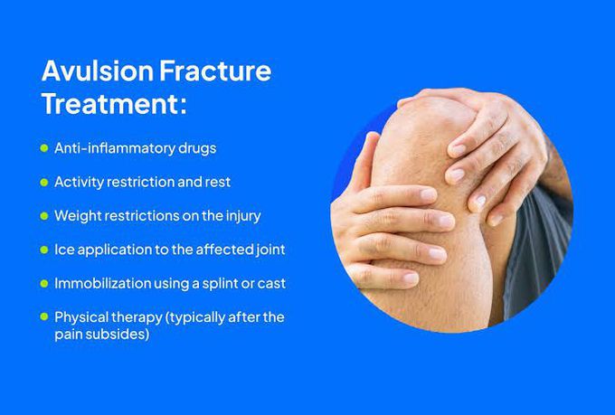 Treatment of avulsion fracture