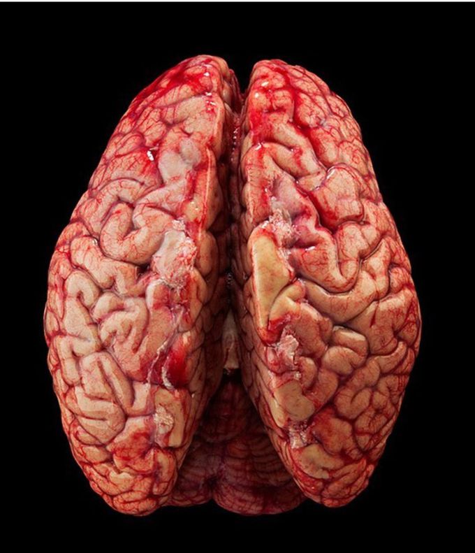 Human brain