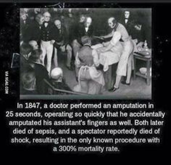 Doctor name was Robert Liston