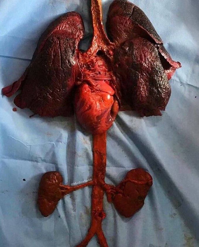 Major organs of the body