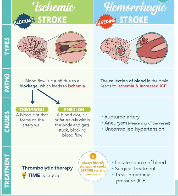 Stroke - MEDizzy