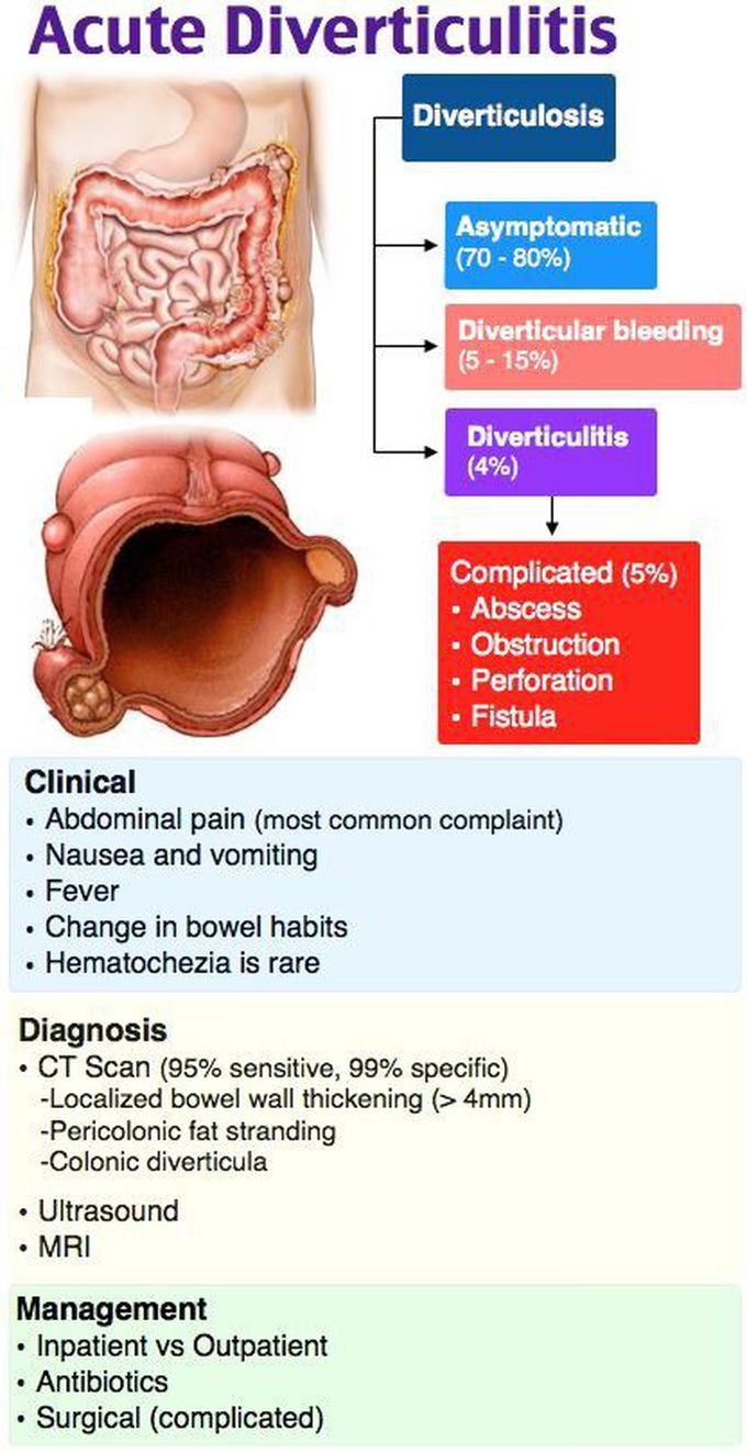 Acute diverticulitis