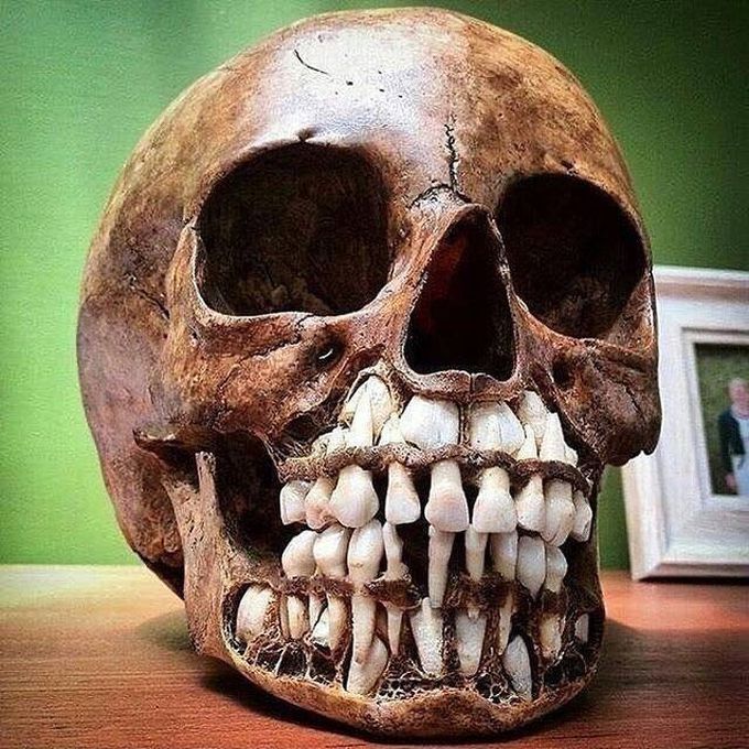 The skull of a Child