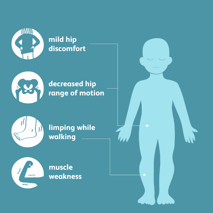 These are the symptoms of Legg calve perthes syndrome MEDizzy