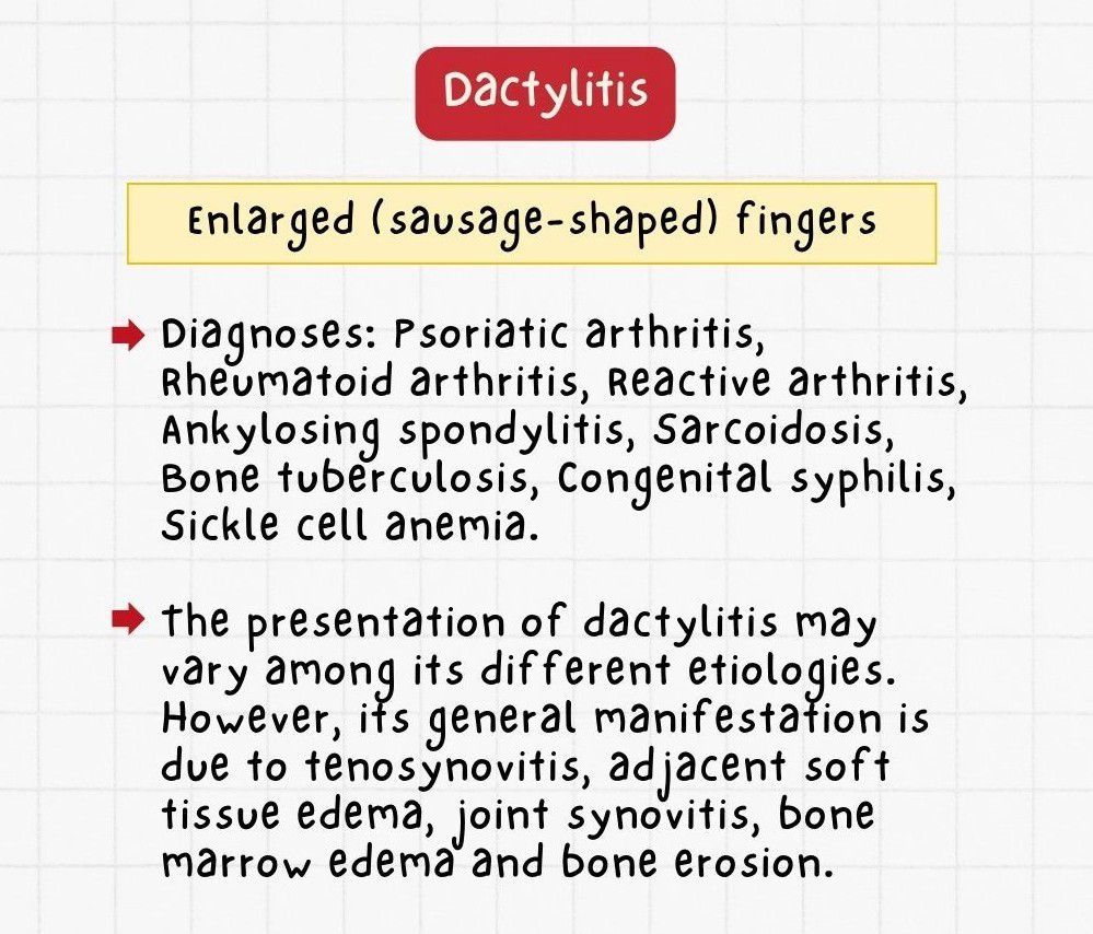 Dactylitis - MEDizzy