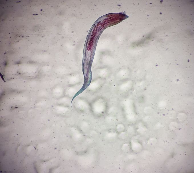 Microscopic image of Enterobius vermicularis