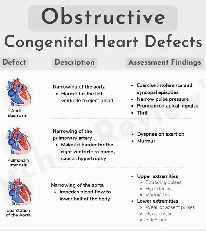 Obstructive Congenital Heart Defect