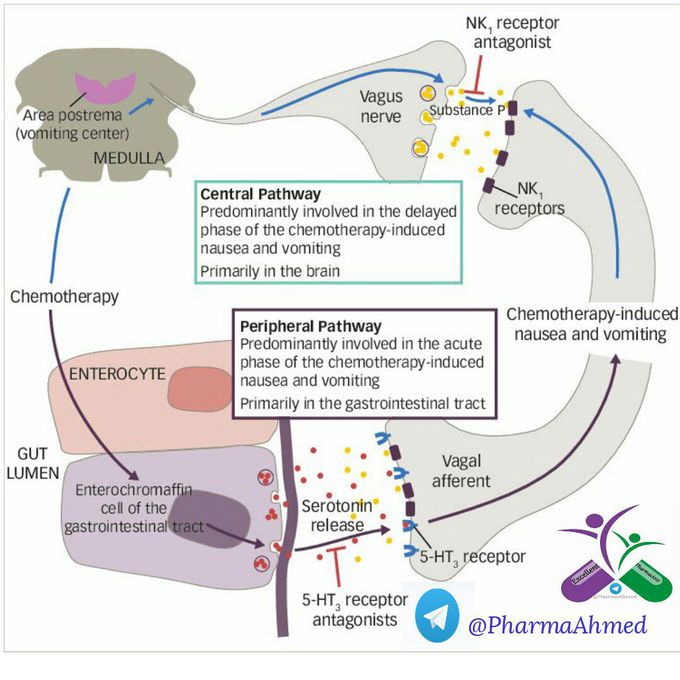 Chemotherapy who it can leads to vomiting